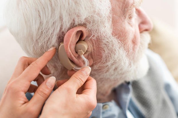 VA Disability Rating For Hearing Loss VADC   Prevalence Of Hearing Loss Among Veterans 